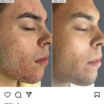 Suna Görer Güzellik Merkezi (Gebze) Güzellik Merkezindeki Görsel Paylaşımların Gerçekliği Tartışma Konusu