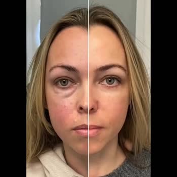 Suna Görer Güzellik Merkezi (Gebze) Güzellik Merkezindeki Görsel Paylaşımların Gerçekliği Tartışma Konusu