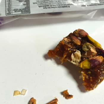 Efe Şekerleme Dolgum Ve Dişim Kırıldı!