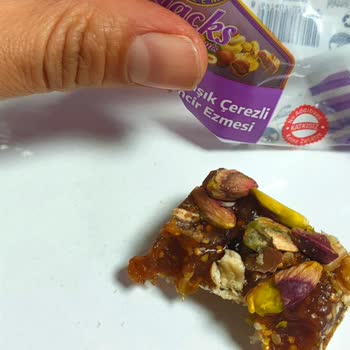 Efe Şekerleme Dolgum Ve Dişim Kırıldı!