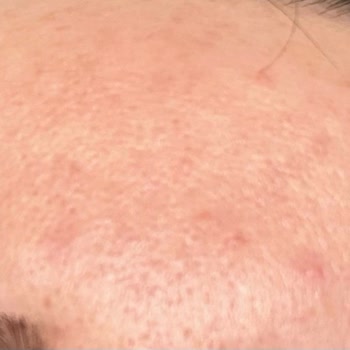 Maruderm Yüz Yıkama Jeli Sorunsalı