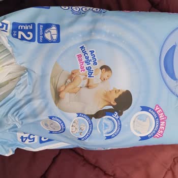 Molfix Bez Alerjisi Bebekler İçin Tehlikeli