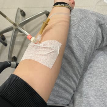 Gurmepack Sokak Lezzetleri Zehirlenmesi