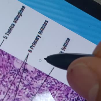 Samsung Telefon Spen Kalem Ucunda Sıkıntı Var