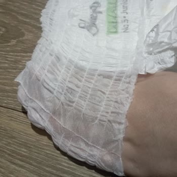 Sleepy Külot Bez Sorunu