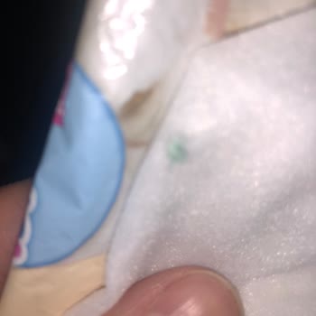 Molfix Islak Mendile Yapışık Yabancı Cisim