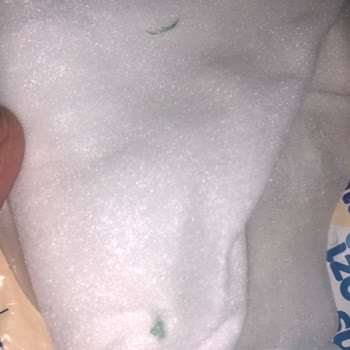 Molfix Islak Mendile Yapışık Yabancı Cisim