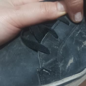 adidas FLO Şikayet Ediyorum