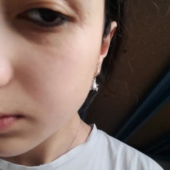 Wet N Wild Kapatıcı Göz Çevresinde Kabartı Şişlik Yaptı