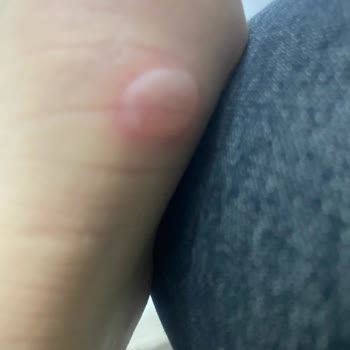 Greyder Markasının Müşteriyi Mağdur Etmesi Ve Çözüm Odaklı Olmaması