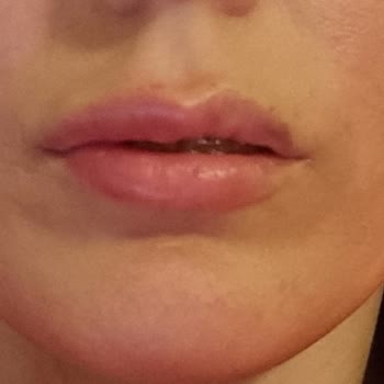 Vist Clinic (Bakırköy) Pişmanlıktır