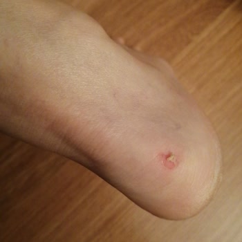 Mall Of Antalya Greyder Mağazası Ayakkabı Değişimi Yapmıyor!