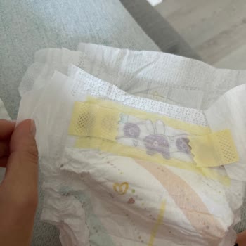 Prima Premium Care Bant Kopma Sorunu