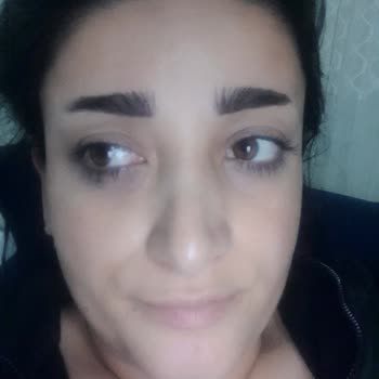 Özel Okmeydanı Hastanesi Okmeydanı Özel Hastanesi Lazer Kaşıma Atış Yapıldı