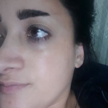 Özel Okmeydanı Hastanesi Okmeydanı Özel Hastanesi Lazer Kaşıma Atış Yapıldı