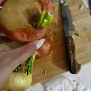 Migros Çürük Ürün Gönderilmesi Ve Müşteri Hizmetlerinin Bunu Umursamaması