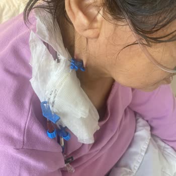 Ankara Bilkent Şehir Hastanesi Lütfen Onkoloji 3/c 10 No Yardım Edin