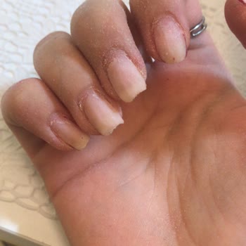 Hazal Akbay Beauty Kasada Fazla Ücret Alıyor