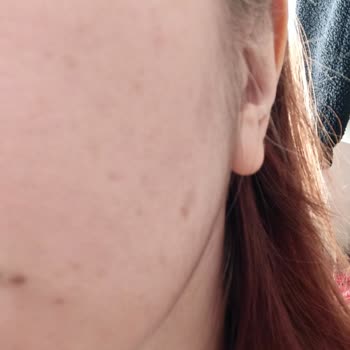 Bee Beauty Organik Sertifikalı Krem Yüzümü Resmen Kızarttı