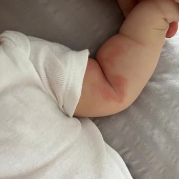 Mustela Stelatopia Vücut Kremi