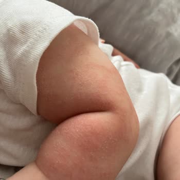 Mustela Stelatopia Vücut Kremi