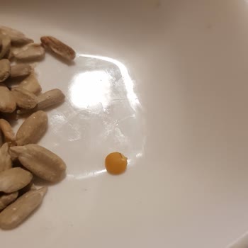 Çerezya İç Çekirdeği Diş Dolgumu Kırdı