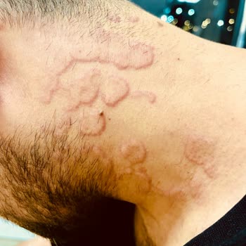 Atabay İlaç Firması Sigara Bırakma İlacının Yan Etkileriyle Mücadele