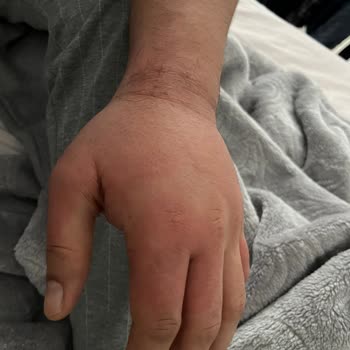 Atabay İlaç Firması Sigara Bırakma İlacının Yan Etkileriyle Mücadele
