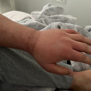 Atabay İlaç Firması Sigara Bırakma İlacının Yan Etkileriyle Mücadele