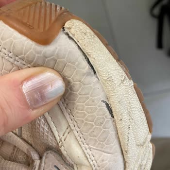 Skechers Marka Ürünün Arkasında Durmuyor!