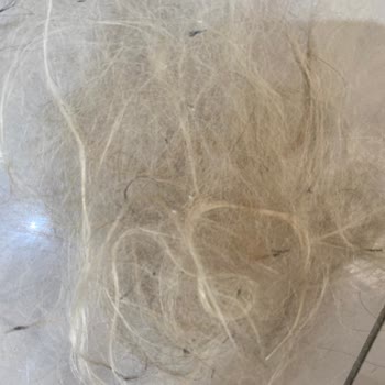 Mehmet Eken-Sare Eken Kuaför Yapılan Kaynak Saç Uygulamasından Yaşanan Mağduriyet