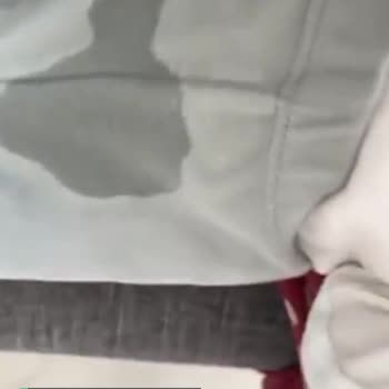 Molfix Çişi Geçiriyor, Bu Yüzden Vücutta Kızarıklık Oldu