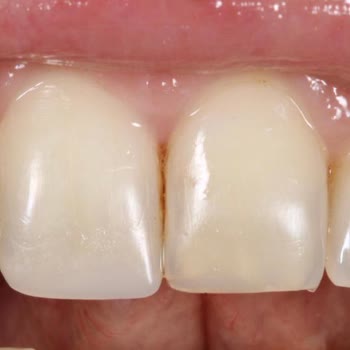 Dentgroup Açıldığından Beri Gittiğim Klinikten Düşmanca Kovuldum