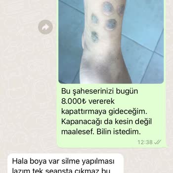 Ayten Kömürcü Kalıcı Makyaj Stüdyosu Sosyal Medyada Yankı Bulan Dövme Silme Problemleri