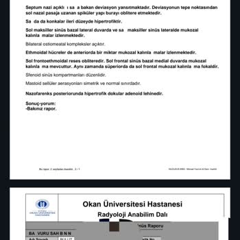 Mapfre Sigorta Ameliyat Masrafını Karşılamıyor