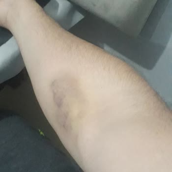 Yeni Hayat Tıp Merkezi Sağlık Raporu Sürecinde Yaşanan Sorunlar