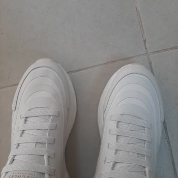 Skechers Sadece 2 Günlük Kullanım Sonrası Ayakkabıda Kırılma Ve Çökme!