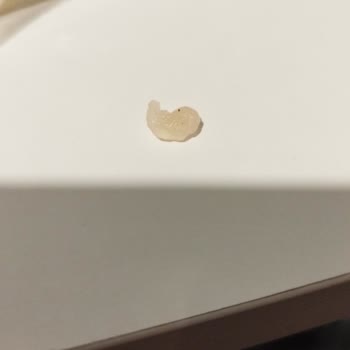 A101 Peynirden Çıkan Bilinmeyen Ürün