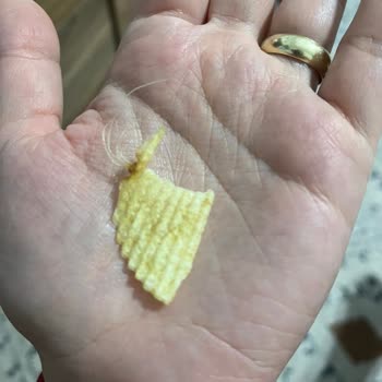 Ruffles Cips Paketinden Yabancı Cisim Çıktı