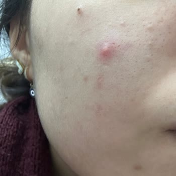 The Purest Solutions The Purest Tonik