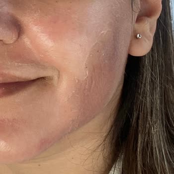 Selin Beste Kan Güzellik Yüz Bakımı Sonrası Yaşanan Sorunlar Ve Müşteri Pişmanlığı