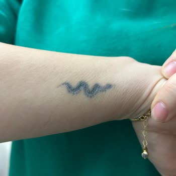 Isabel Zey Beauty Dövme Sildirme Seansı Başarısız