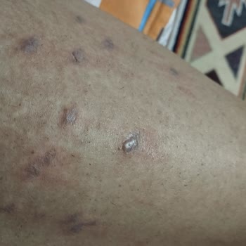 Esse Life Konya Sıfır Hizmet Ve Bozuk Cihazla İnsanları Yakıyorlar