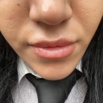 Bahar Acar Güzellik Merkezi Hatalı Yapılan İşlem