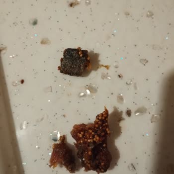 Çerezya Ürün İçinden 1 Cm Taş Çıkması
