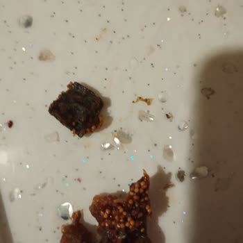 Çerezya Ürün İçinden 1 Cm Taş Çıkması