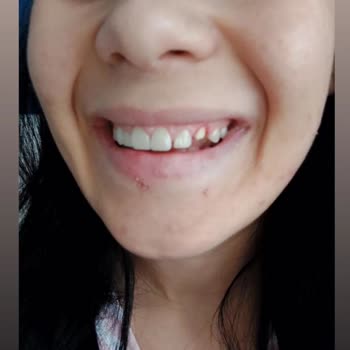 Özel Yalı Ağız Ve Diş Sağlığı Polikliniği Memnuniyetsizliği