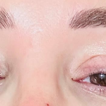 La Derma Beauty Center Hayal Kırıklığı