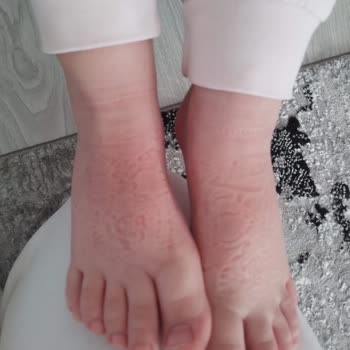 Zara Müşteri Hizmetleri Kabalığı Ve Sorun Çözememe