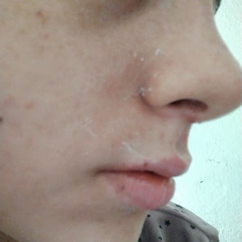 Yves Rocher Güneş Kremi Topaklanma Problemi